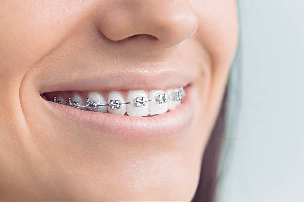 Best Teeth Whitening  in Diaz, AR